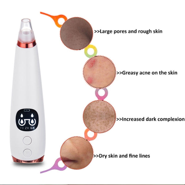 Electric Blackheads Remover - Facial Steamer Spa