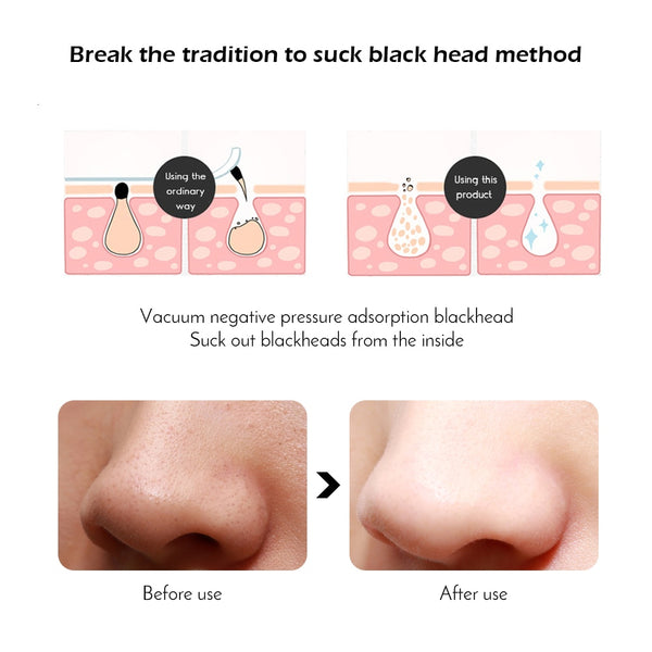 Electric Blackheads Remover - Facial Steamer Spa